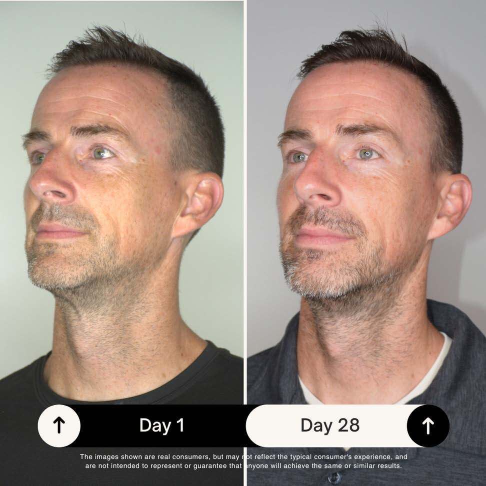 a side by side photo of a man after using Visage Collection skincare by THREE